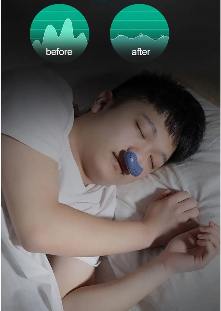 Electric Anti-snoring Respirator